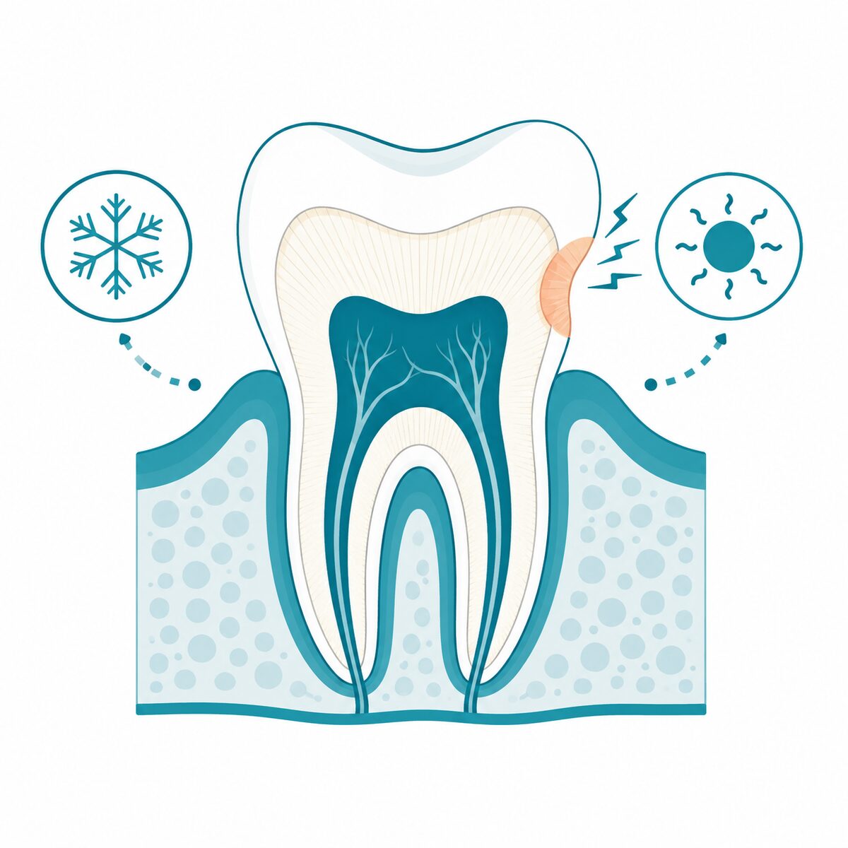 Sensitive Teeth: Why It Happens and How to Fix It